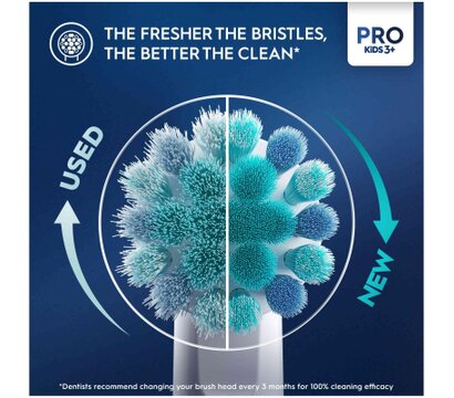 Изображение 6 Зубная щетка Oral-B D103.413.2KX Frozen